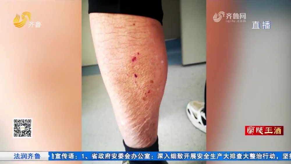 济南：七旬老人捡废品被未牵绳的狗咬伤 如何维权？