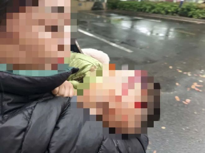 湖南常德公安交管直属六大队：公务途中伸援手 警灯闪烁护生命